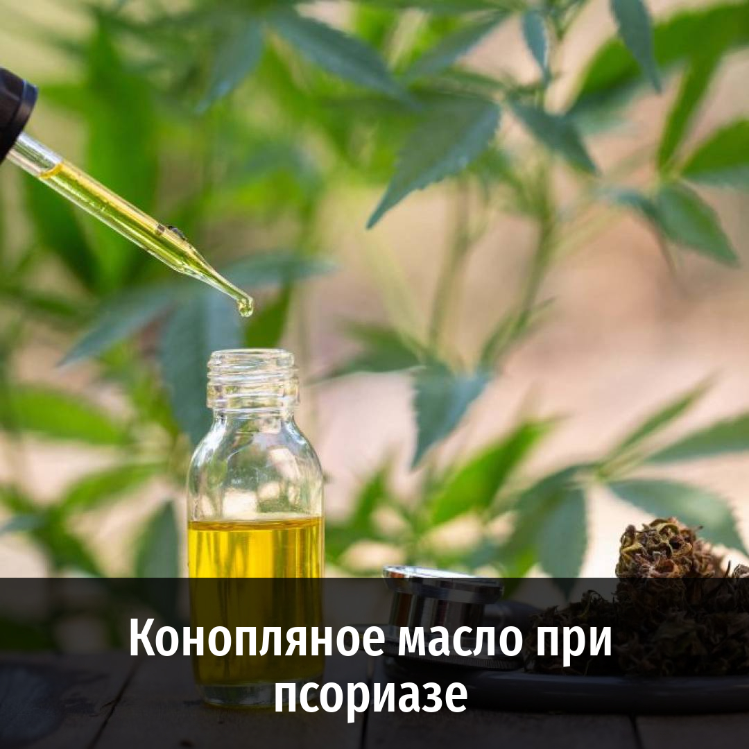 конопля от псориаза конопля от псориаза